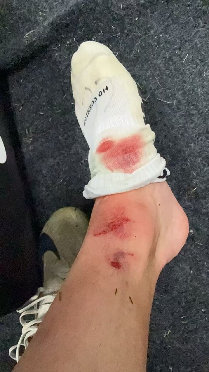 李帅拼至流血仍不停歇